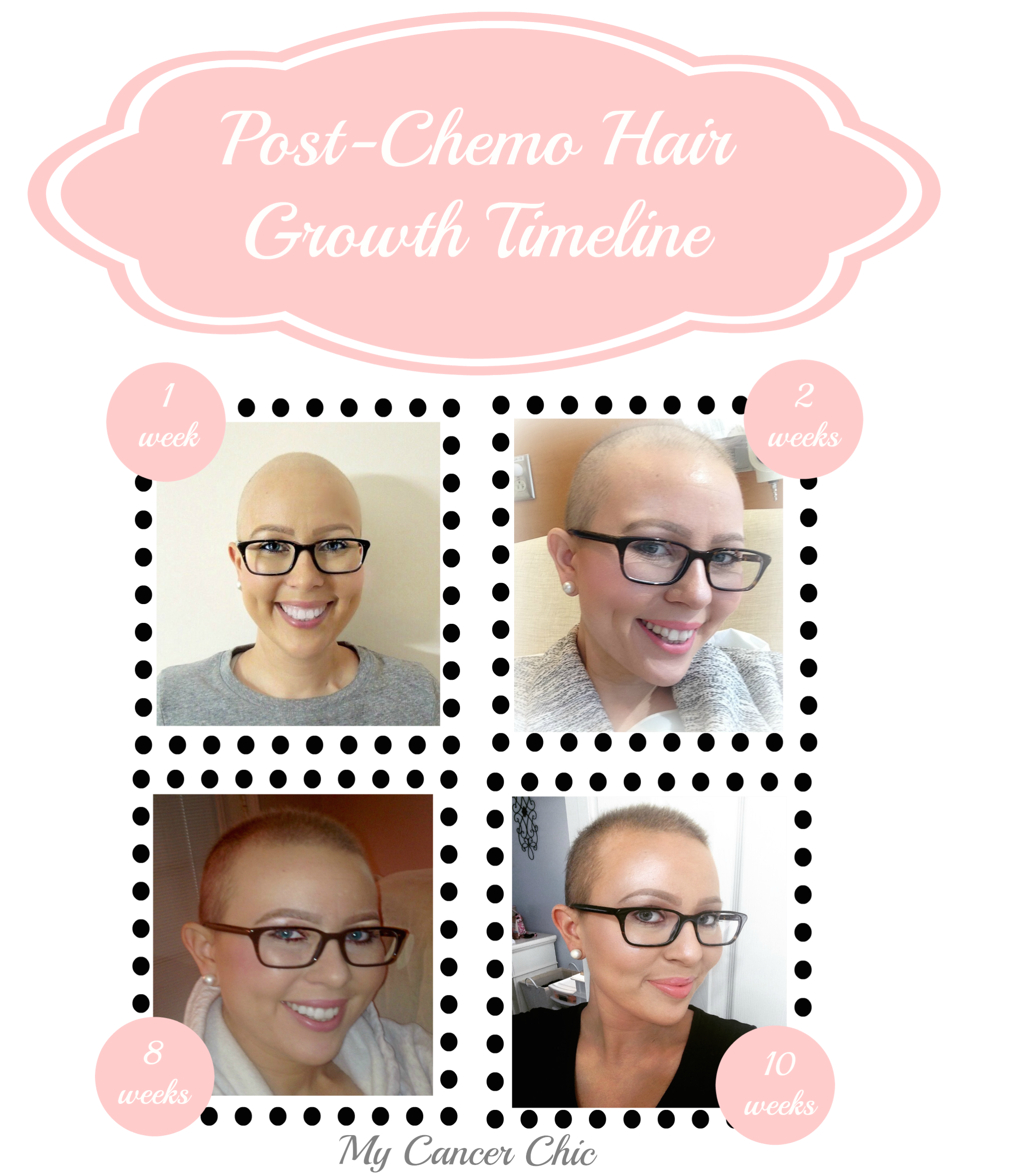post-chemo hair growth + styling tips - lacuna loft